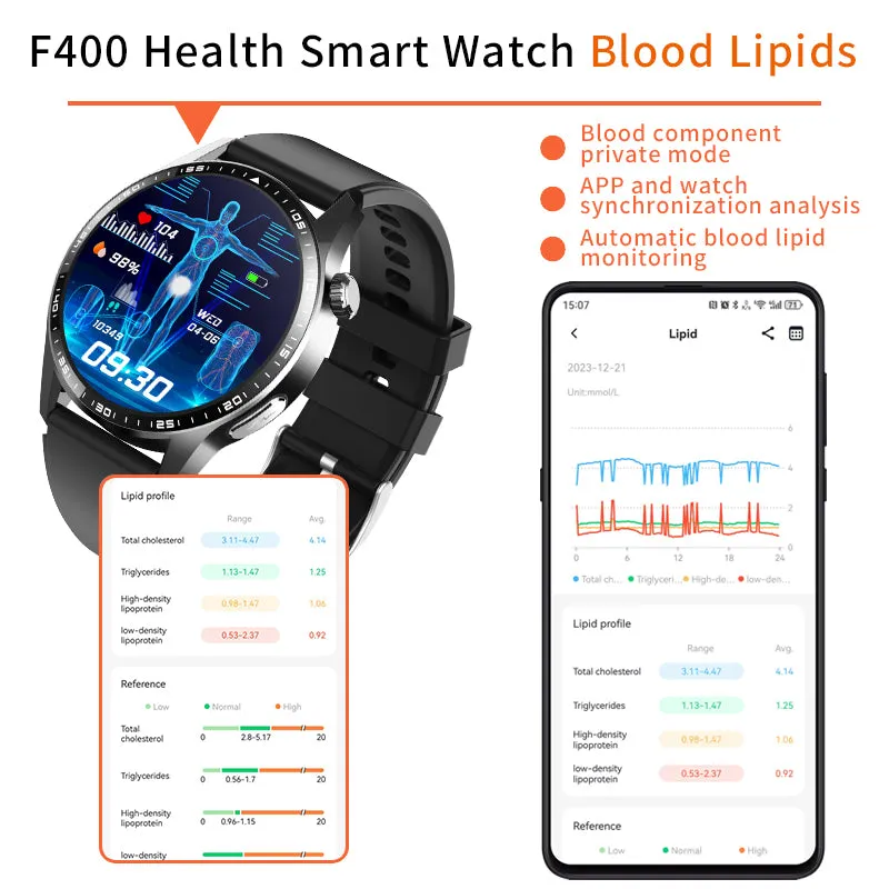 Healthy Blood Oxygen Smart Watch Men ECG PPG Precise Body Temperature Heart Rate Monitor Smartwatch HRV Blood Pressure Watches